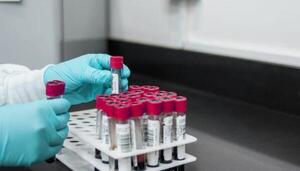 Diario HOY | Investigadores detectan por primera vez microplásticos en la sangre humana