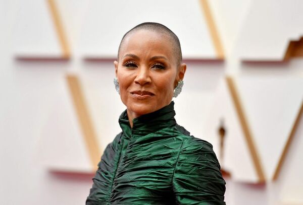 La alopecia de Jada Pinkett podría ser un trastorno genético y autoinmune - Gente - ABC Color