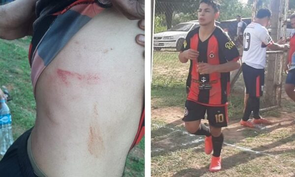 Atacan con kyse a pelotero por meter un gol. “Me patearon y sacaron un cuchillo”