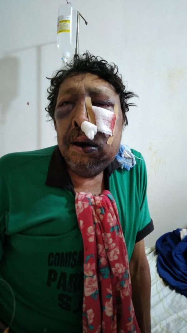 Piden ayuda para un señor que fue brutalmente golpeado