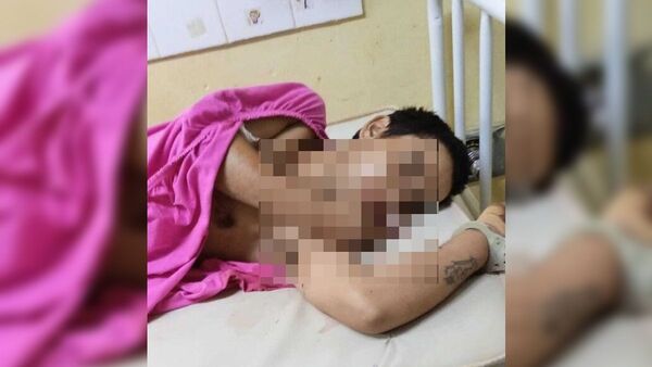 Torturan e intentan cortarle la lengua a delincuente