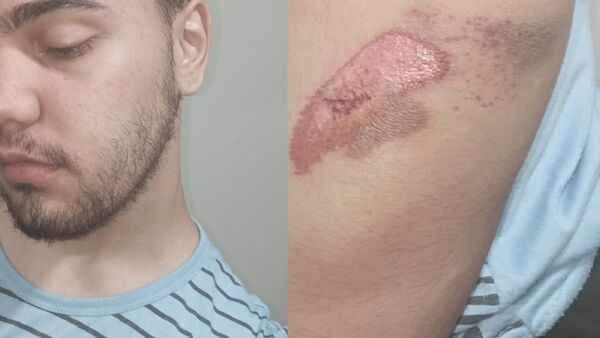 Joven sufrió lesiones tras caer de ómnibus en Encarnación