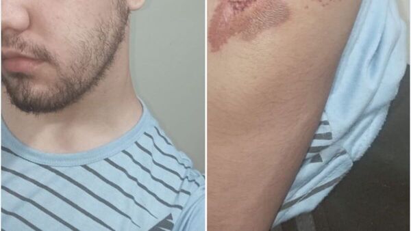 Chofer aceleró y estudiante cayó del micro