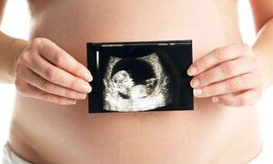 Espacio para todas las mamis, Hospital Pediatrico Municipal de Encarnación brindará ecografía gratuita