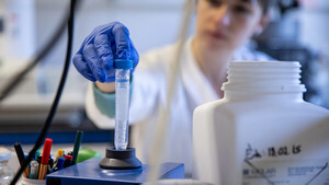 Diario HOY | Nueva variante "XE" de ómicron podría ser la más contagiosa de todas las cepas de COVID