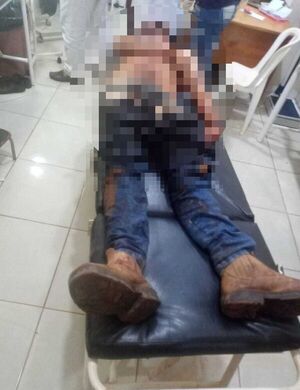 Discusión en juego de billar deja una víctima fatal - ABC en el Este - ABC Color
