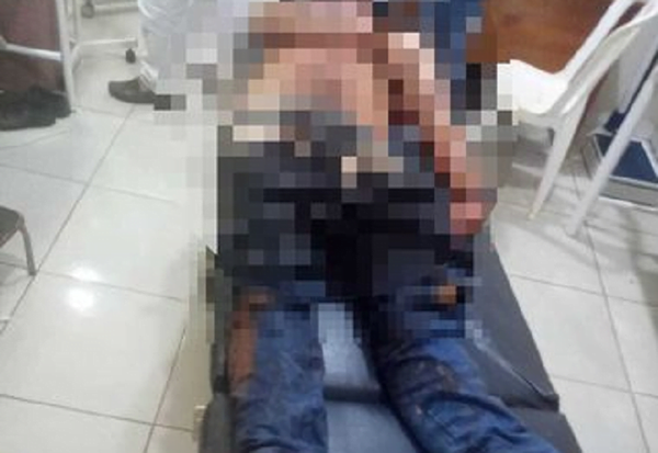 Discusión en juego de billar deja una víctima fatal - Noticiero Paraguay