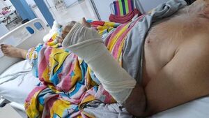 Hernandarias: funcionaria de la municipalidad chocó a un motociclista y niega su responsabilidad