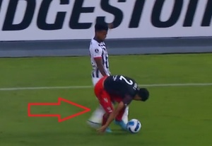 “No tuve mala intención”, afirma Aldair luego de quebrar a Rojas - La Prensa Futbolera