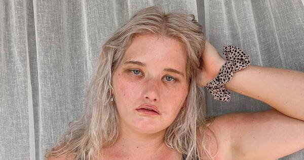 La Nación / Toda su vida sufrió bullying y ahora será modelo
