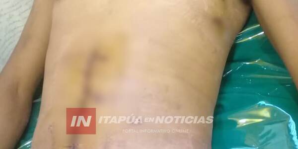 PIDEN CAPTURA DE PRÓFUGO TRAS BRUTAL ATAQUE EN OBLIGADO - Itapúa Noticias