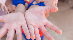 Aumento de virus de pie, mano y boca: hay que insistir en higiene en niños