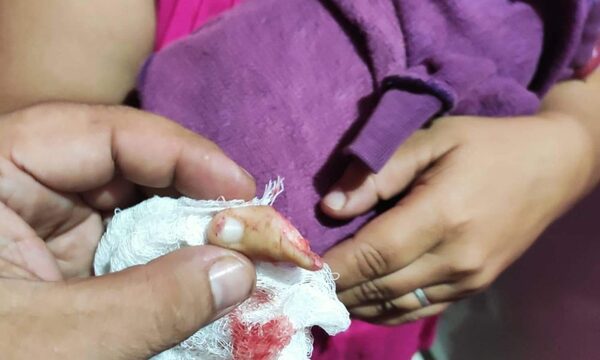 Denunció a adictos y le cortaron el dedo