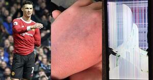 Mamá de niño agredido por Ronaldo: “Mi hijo es autista y le arruinó el día”