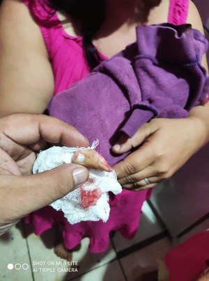 Adictos irrumpen vivienda de mujer y le cortan el dedo con chuchillo - La Clave