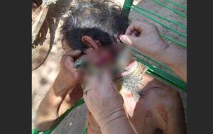 Tras discusión, hombre fue gravemente herido con un machete en Coronel Oviedo – Prensa 5