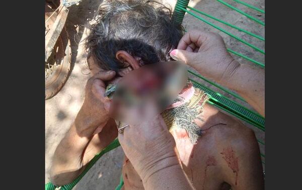 Tras discusión, hombre fue gravemente herido con un machete en Coronel Oviedo – Prensa 5