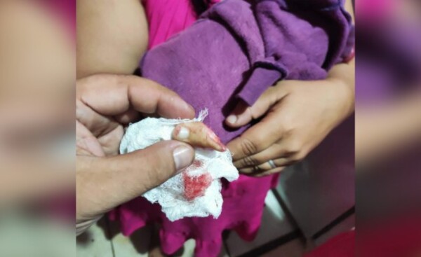 Vecinos irrumpen una casa y le cortan el dedo a una mujer