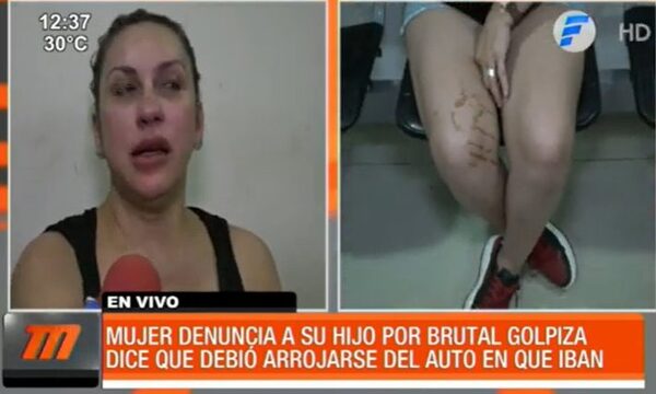Denunció a su hijo por brutal golpiza | Telefuturo
