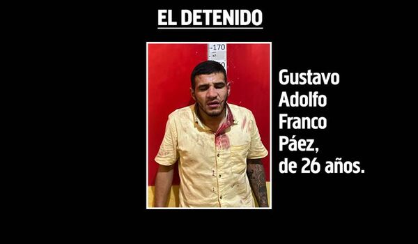 Adicto mata a su tío en duelo con cuchillos - Nacionales - ABC Color