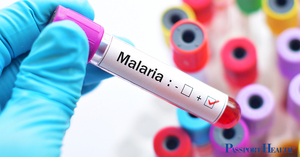 Fortalecen sistema de alerta para evitar reintroducción de la malaria - ADN Digital