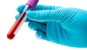 En el Día Mundial de la Hemofilia, apelan por un tratamiento oportuno y multidisciplinario - El Independiente