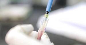 La Nación / Los pacientes hemofílicos mejoran con tratamiento