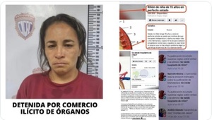 Diario HOY | Detienen en Venezuela a mujer que ofrecía un riñón en redes sociales