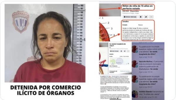 Diario HOY | Detienen en Venezuela a mujer que ofrecía un riñón en redes sociales