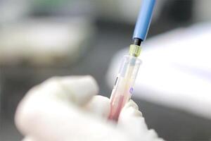 Tratamiento oportuno y manejo multidisciplinario son pilares para la calidad de vida de los pacientes hemofílicos | Lambaré Informativo