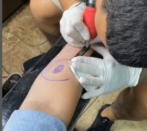 ¡Novia “tóxica” dejó su huella dactilar en el brazo de su novio!