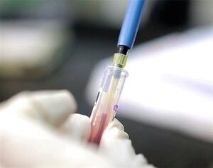 Día Mundial de la Hemofilia: Recomiendan detectar y tratar a tiempo la enfermedad para llevar una vida plena – La Mira Digital