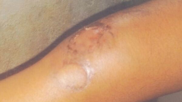 La nueva novia de su exconcu le mordió