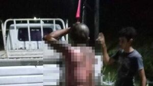 Hombre se derramó combustible y luego se prendió fuego