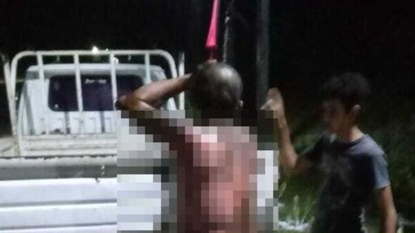 Hombre se derramó combustible y luego se prendió fuego