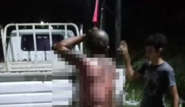 Hombre se derramó combustible y se prendió fuego - Noticiero Paraguay