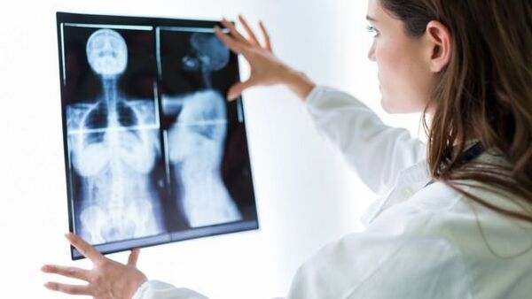 Diario HOY | Descubren factor que explica la metástasis de huesos en el cáncer de mama