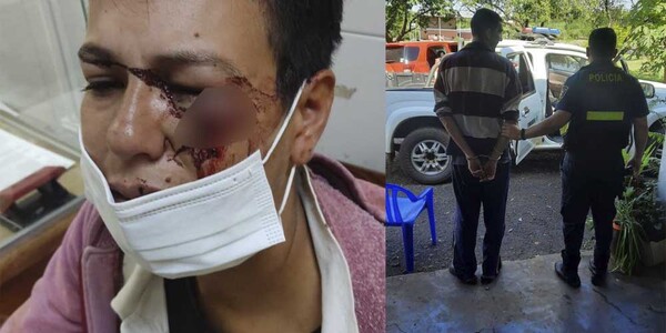 BRUTAL AGRESIÓN CONTRA UNA MUJER EN SAN JUAN DEL PARANÁ
