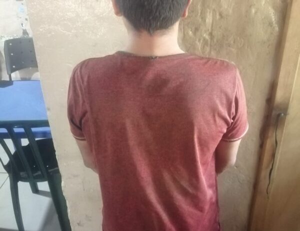 Acuchilló y mordió a su hermano porque se le terminó el alcohol