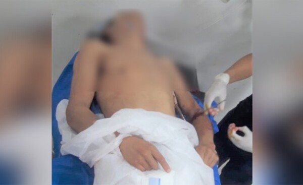 Imputan a presunto ladrón acuchillado por un guardia