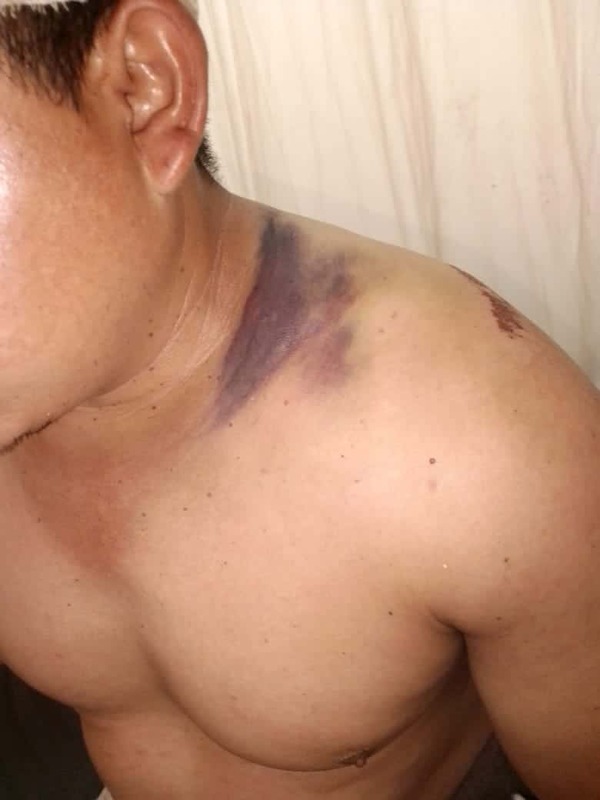 Familiares de un joven denuncian que policías lo golpearon e hicieron pasar el hecho como accidente
