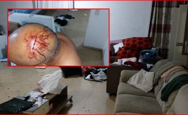 Asaltan vivienda, toman de rehén a pareja y se llevan G. 20 millones
