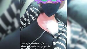 Sobredosis de quimio: "Ya no tengo fuerzas"