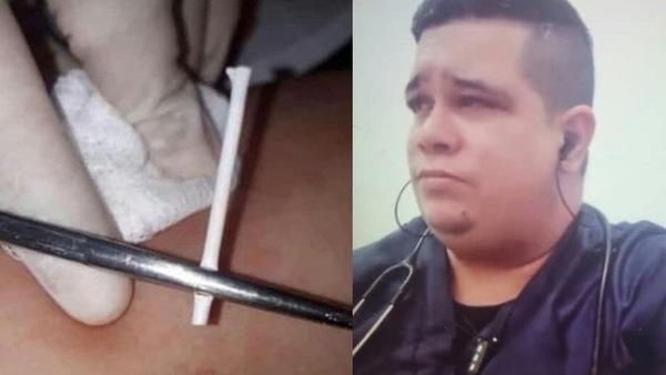 ¡Terrible! Falso médico es buscado por utilizar como método anticonceptivo «palitos de chupetín intradérmicos»
