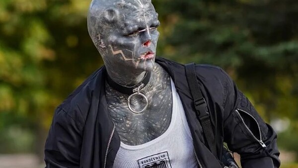 El hombre que quiere parecer un alien dice que ahora se amputará una pierna