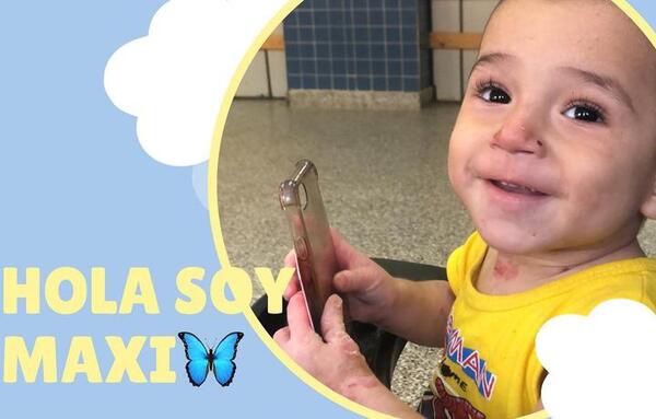 Maxi, el bebé con “piel de cristal” que necesita viajar a España para su tratamiento