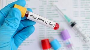OMS alerta que la nueva hepatitis es un tema "muy urgente"
