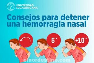 Consejos de Universidad Sudamericana para detener una hemorragia nasal causada por irritaciones menores o resfriados
