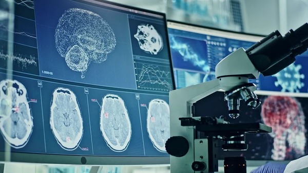Diario HOY | Qué cambios produce el coronavirus en el cerebro y cómo se vinculan con el COVID prolongado