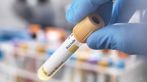 Diario HOY | Portugal detecta 4 casos sospechosos de hepatitis aguda en niños